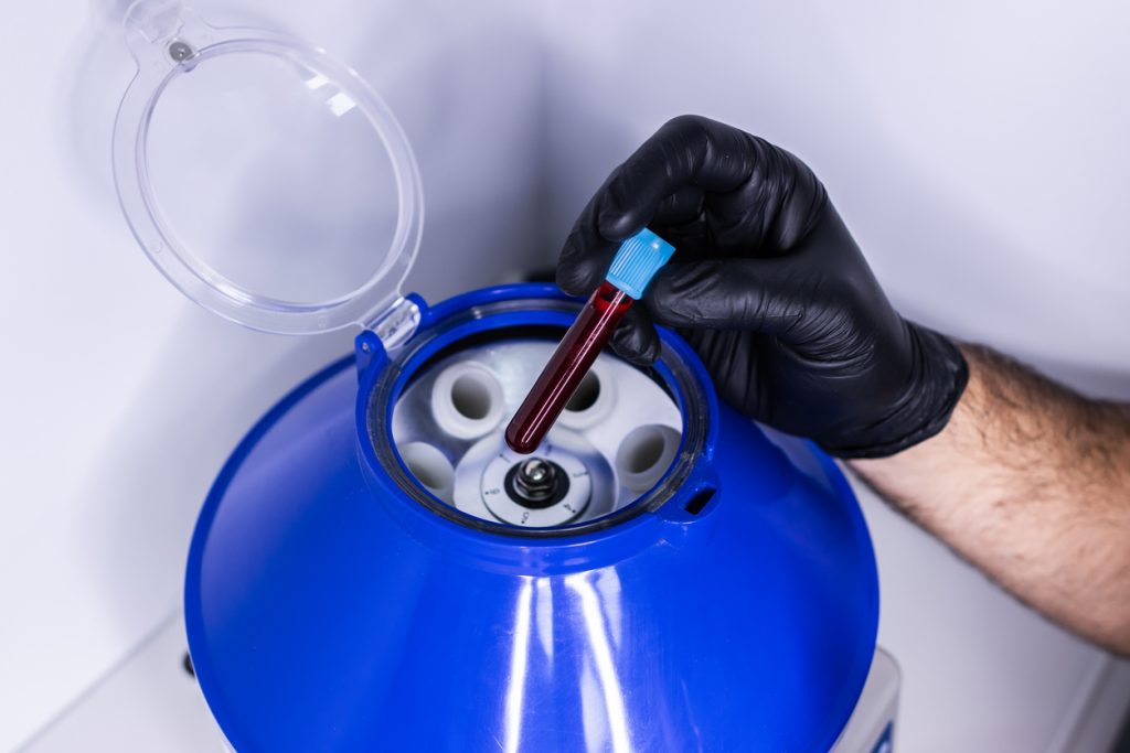 Close up of the hands of a doctor putting a test tube with blood in a centrifuge to separate plasma from blood.